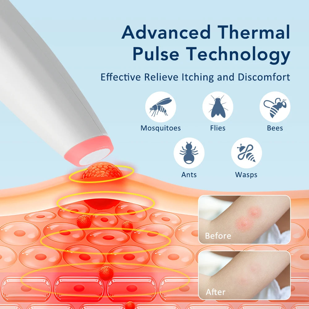 BioZap Your Bites Away – No Creams. No Chemicals.