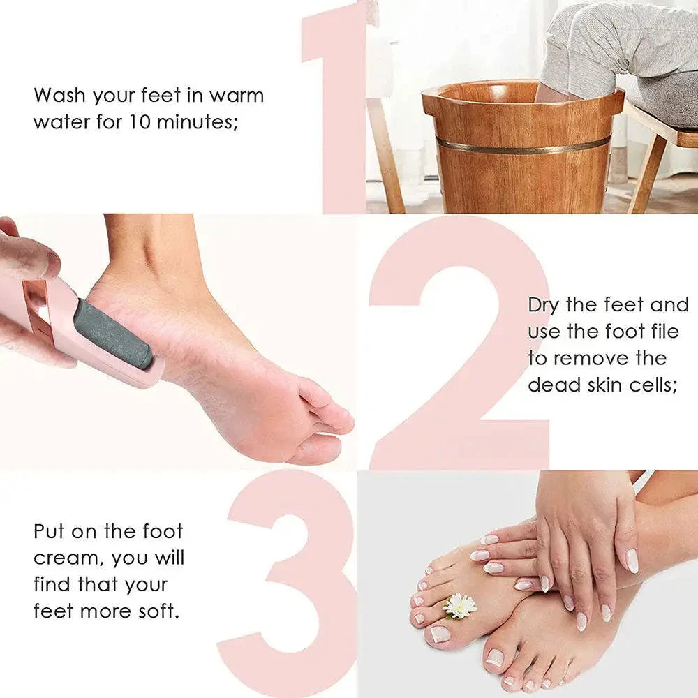 SmoothEase™ Electric Callus Remover