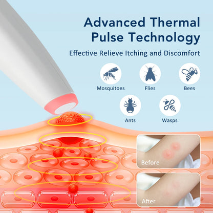 BioZap Your Bites Away – No Creams. No Chemicals.